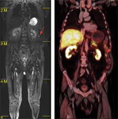 body-mri-image