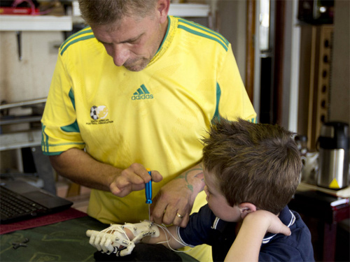 Richard Van As assembling Robohand for Liam Dippenaar, see NPR.org.